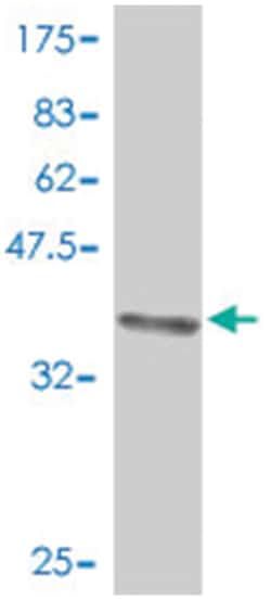 DBC1, Mouse, Polyclonal Antibody, Abnova 50 &mu;L | Buy Online | Abnova | Fisher Scientific