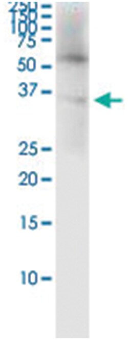 anti-DBC1, Human, IP-WB Antibody Pair, Abnova&trade;