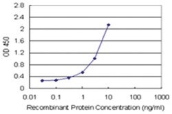 anti-DCTD Matched Antibody Pair, Abnova 1 Set:Antibodies, Monoclonal/Polyclonal