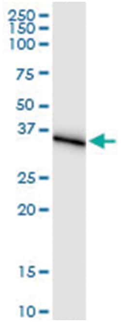 anti-AKR1C1, Human, IP-WB Antibody Pair, Abnova 1 Set:Antibodies, Monoclonal/Polyclonal