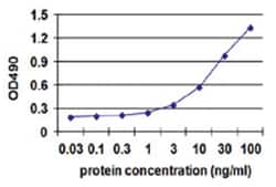 AKR1C2, Human, Matched Antibody Pair (AP22), Abnova&trade;
