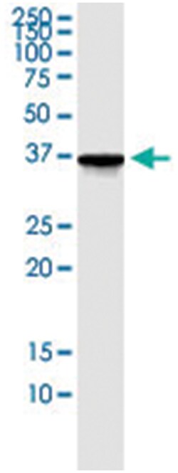 anti-AKR1C2, Human, IP-WB Antibody Pair, Abnova 1 Set:Antibodies, Monoclonal/Polyclonal