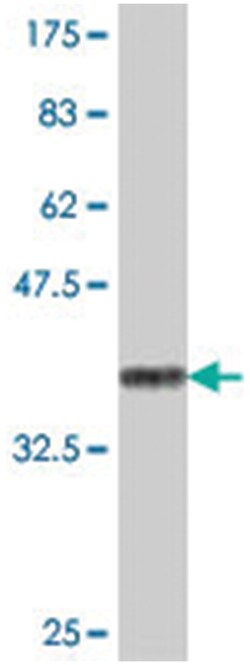 DDOST, Mouse, Polyclonal Antibody, Abnova 50&mu;L; Unlabeled:Antibodies,