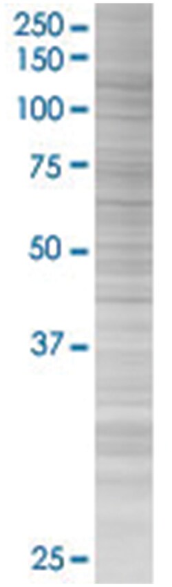 DDX11 293T Cell Overexpression Lysate (Denatured), Abnova 100 &mu;l | Buy Online | Abnova | Fisher Scientific