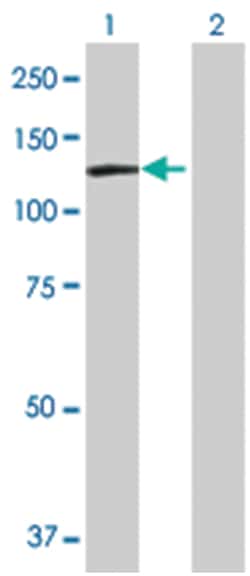 DDX11 293T Cell Overexpression Lysate (Denatured), Abnova 100 &mu;l | Buy Online | Abnova | Fisher Scientific