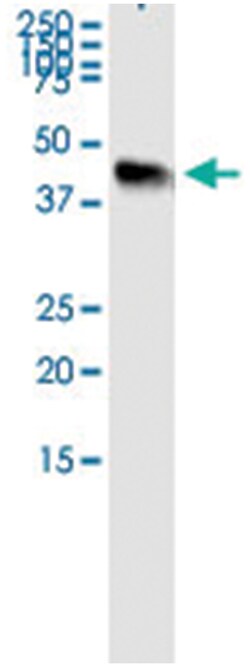 anti-DFFA, Human, IP-WB Antibody Pair, Abnova&trade;
