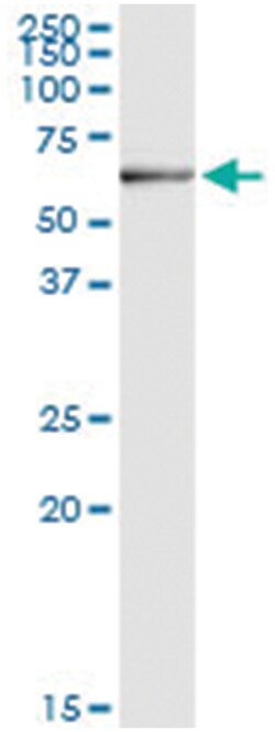 anti-DHCR24, Human, IP-WB Antibody Pair, Abnova™