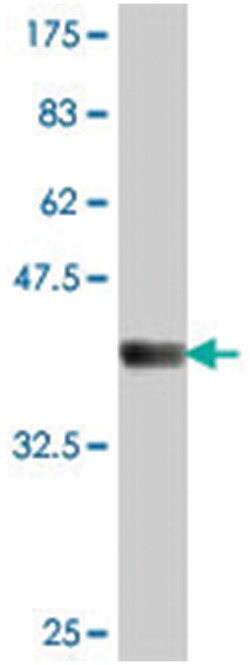 DIAPH1, Mouse, Polyclonal Antibody, Abnova 50&mu;L; Unlabeled:Antibodies,