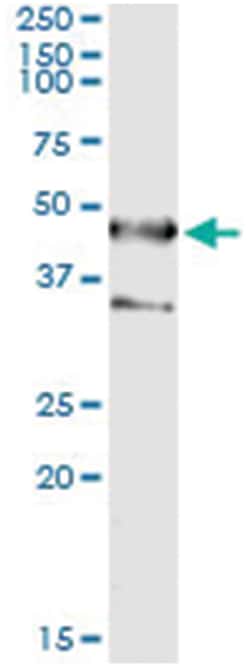 SEPT1, Human, IP-WB Antibody Pair (PW2), Abnova 1 Set:Antibodies, Monoclonal/Polyclonal
