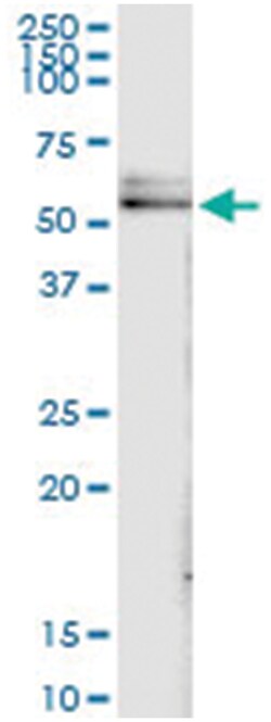anti-DLST, Human, IP-WB Antibody Pair, Abnova&trade;