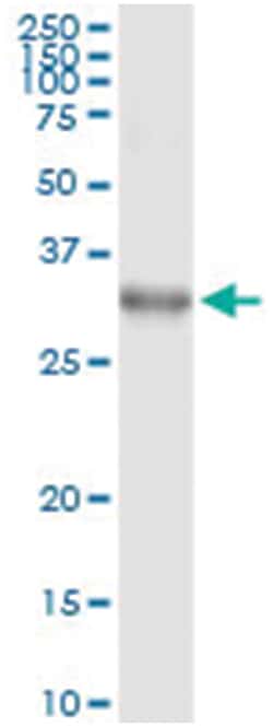 DLX1, Human, IP-WB Antibody Pair (PW1), Abnova™