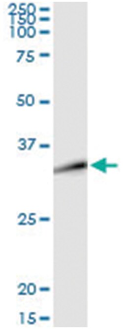 DLX1, Human, IP-WB Antibody Pair (PW3), Abnova 1 Set:Antibodies, Monoclonal/Polyclonal