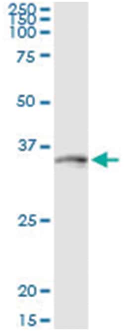 DLX1, Human, IP-WB Antibody Pair (PW4), Abnova&trade;
