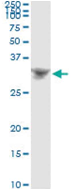 DLX4, Human, IP-WB Antibody Pair (PW1), Abnova&trade;