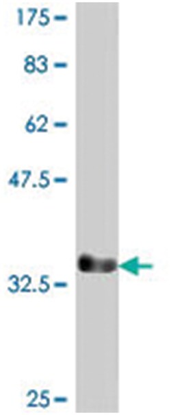 DLX6, Mouse, Polyclonal Antibody, Abnova 50 &mu;L | Buy Online | Abnova Corporation | Fisher Scientific