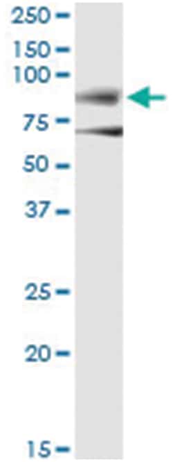 anti-DMD, Human, IP-WB Antibody Pair, Abnova™