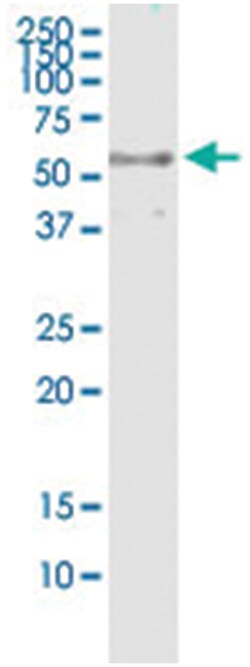 anti-DYNC1LI2, Human, IP-WB Antibody Pair, Abnova&trade;