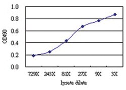 anti-TRDMT1 Matched Antibody Pair, Abnova™