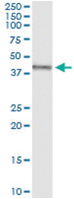 anti-TRDMT1, Human, IP-WB Antibody Pair, Abnova&trade;