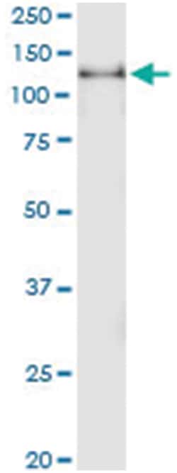 anti-DNMT3A, Human, IP-WB Antibody Pair, Abnova&trade;