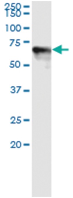 anti-DOK1, Human, IP-WB Antibody Pair, Abnova™