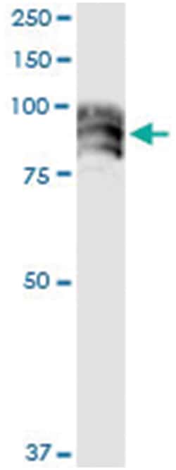 anti-DPP4, Human, IP-WB Antibody Pair, Abnova&trade;