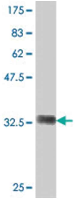 DPYS, Mouse, Polyclonal Antibody, Abnova 50 &mu;L | Buy Online | Abnova Corporation | Fisher Scientific