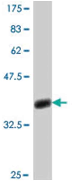SLC26A3, Mouse, Polyclonal Antibody, Abnova 50&mu;L; Unlabeled:Antibodies,
