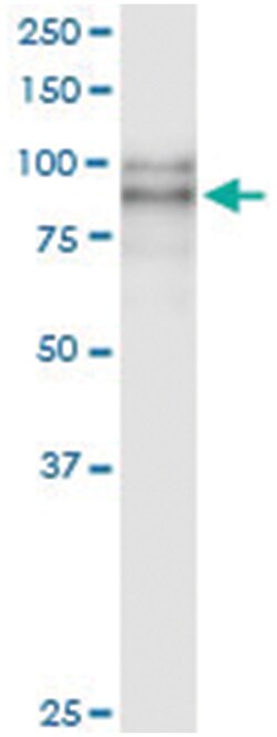 anti-DSC2, Human, IP-WB Antibody Pair, Abnova&trade;