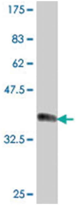 DSC3, Mouse, Polyclonal Antibody, Abnova 50 &mu;L | Buy Online | Abnova Corporation | Fisher Scientific