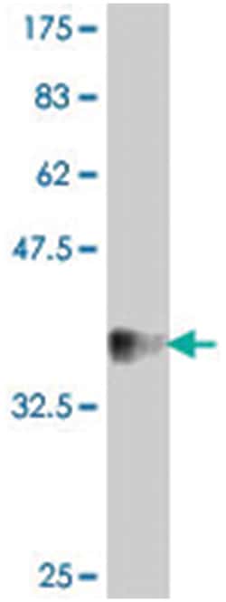 DSCAM, Mouse, Polyclonal Antibody, Abnova 50&mu;L; Unlabeled:Antibodies,