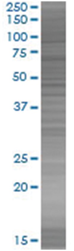 SLC26A2 293T Cell Overexpression Lysate (Denatured), Abnova