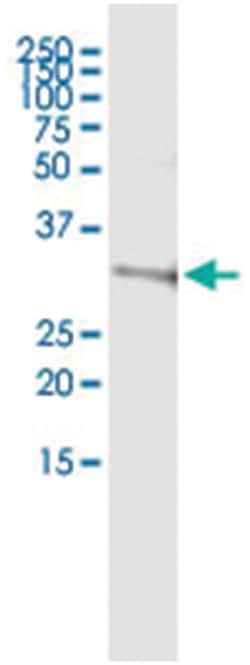 anti-DUT, Human, IP-WB Antibody Pair, Abnova 1 Set:Antibodies, Monoclonal/Polyclonal