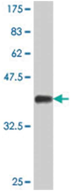 DVL1, Mouse, Polyclonal Antibody, Abnova 50 &mu;L | Buy Online | Abnova Corporation | Fisher Scientific