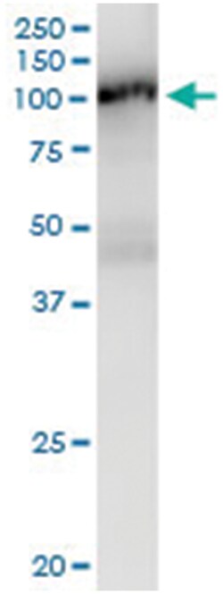 anti-DVL2, Human, IP-WB Antibody Pair, Abnova&trade;