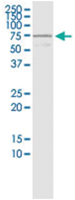 DVL3, Human, IP-WB Antibody Pair (PW2), Abnova&trade;