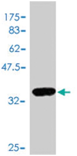 E2F2, Mouse, Polyclonal Antibody, Abnova 50&mu;L; Unlabeled:Antibodies,