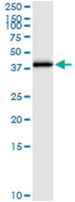 anti-E2F6, Human, IP-WB Antibody Pair, Abnova&trade;