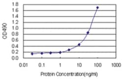 anti-E4F1 Ab-1 Matched Antibody Pair, Abnova 1 Set; Unlabeled:Antibodies,