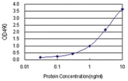 anti-E4F1 Ab-2 Matched Antibody Pair, Abnova™