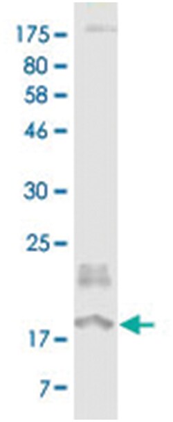 anti-EDA, Clone: 1F6, Abnova 100 &mu;g | Buy Online | Abnova Corporation | Fisher Scientific