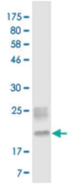 anti-EDA, Clone: 2F2, Abnova 100&mu;g, Unlabeled:Antibodies, Monoclonal