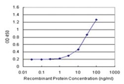 anti-EDN3 Matched Antibody Pair, Abnova