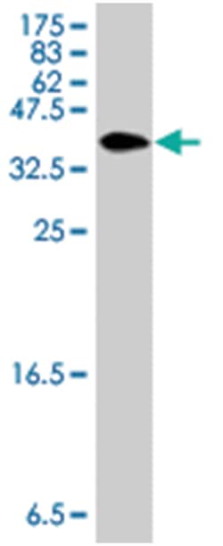 eukaryotic translation elongation factor 1 delta (guanine nucleotide exchange