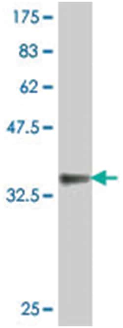 EFNA3, Mouse, Polyclonal Antibody, Abnova 50&mu;L; Unlabeled:Antibodies,