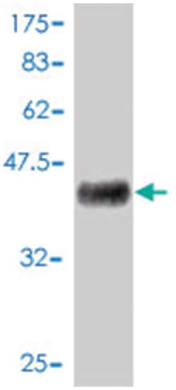 epidermal growth factor (beta-urogastrone), Mouse, Polyclonal Antibody,