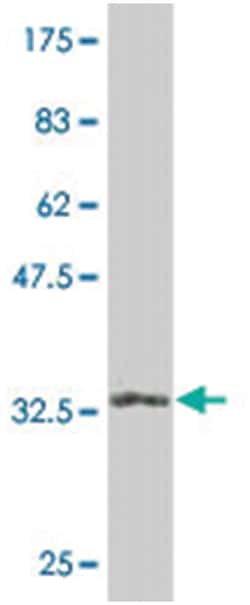 eukaryotic translation initiation factor 4E binding protein 2, Mouse, Clone:
