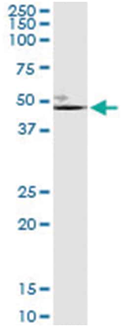 anti-ELN, Human, IP-WB Antibody Pair, Abnova&trade;