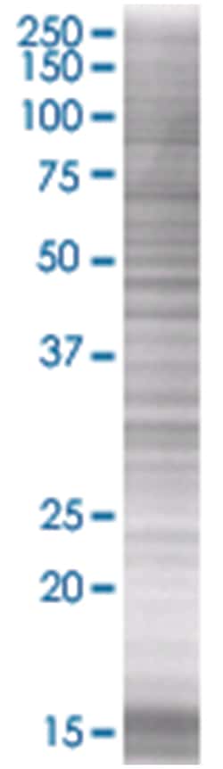 EMD 293T Cell Overexpression Lysate (Denatured), Abnova 100 &mu;l | Buy Online | Abnova | Fisher Scientific