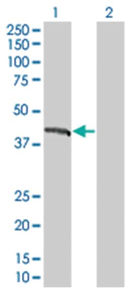 EMD 293T Cell Overexpression Lysate (Denatured), Abnova 100 &mu;l | Buy Online | Abnova | Fisher Scientific